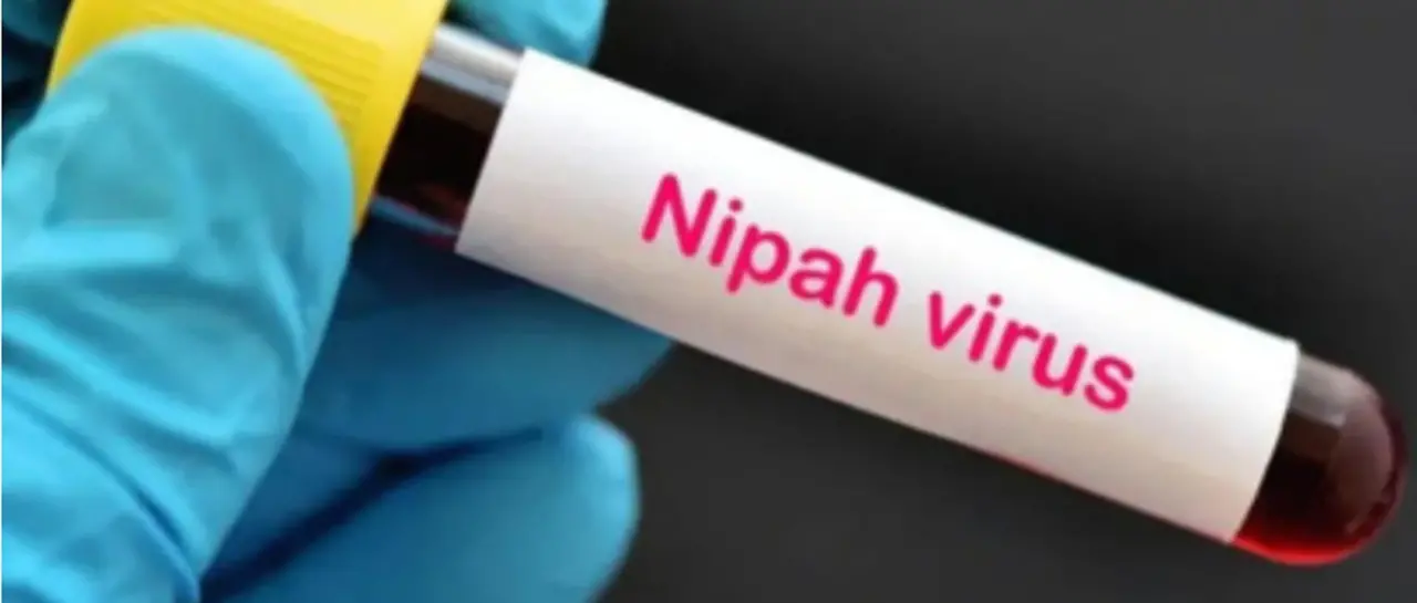 virus_101-14319926_20260128115158